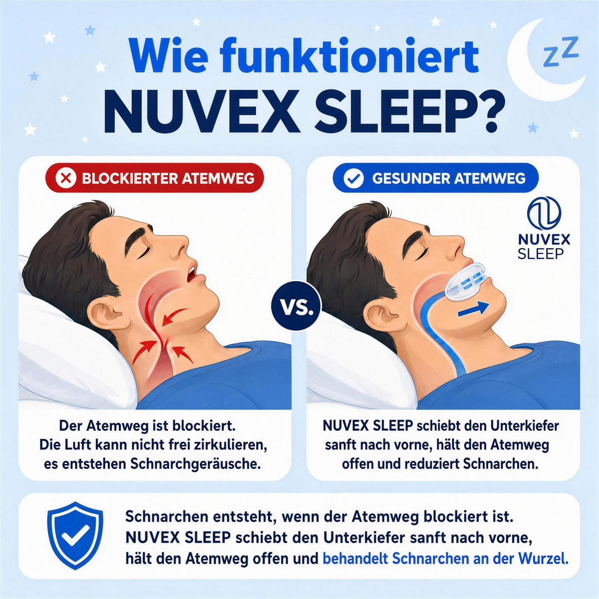 Nuvex Sleep - Anti Schnarch Schiene